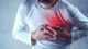 Angina